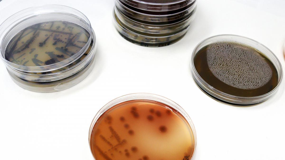 Four petri dishes holding culture, growth and substance in brown colour.