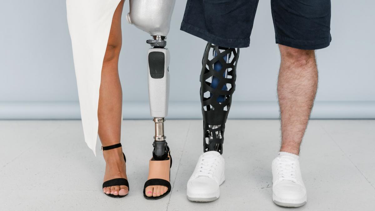 Two pairs of legs of a man (right) and woman (left) side by side, where one leg of each person is a prosthetic leg.