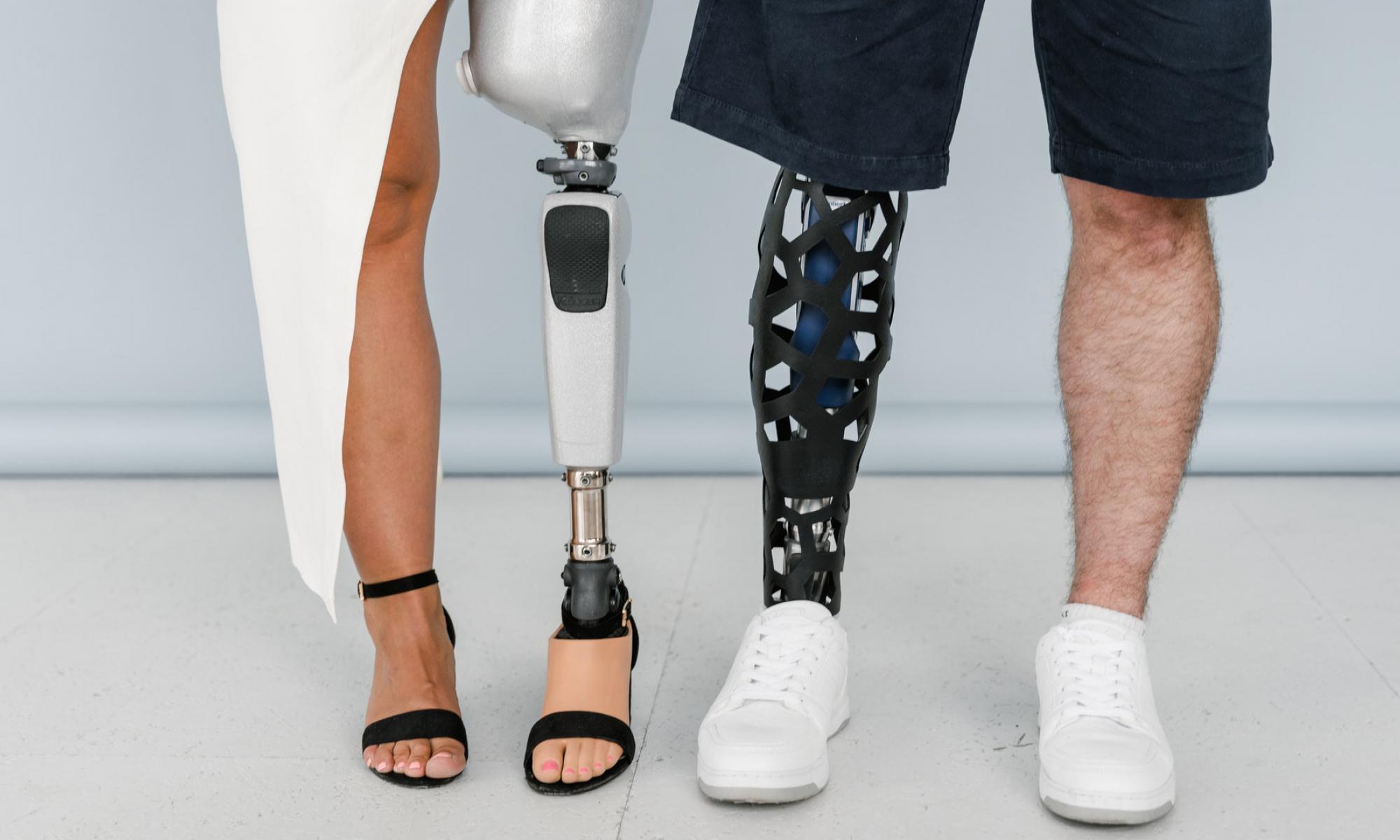 Two pairs of legs of a man (right) and woman (left) side by side, where one leg of each person is a prosthetic leg.